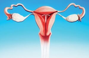Ilustração de um diu inserido dentro de um útero